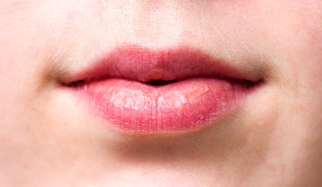 Lips of a woman