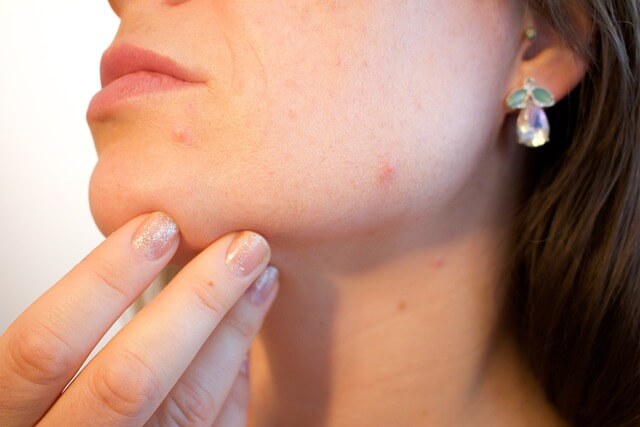 Close-up of a woman examining her cheek, checking for signs of skin purging